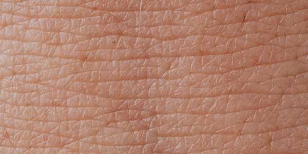 Mupirocin – An Effective Solution for Skin Infections