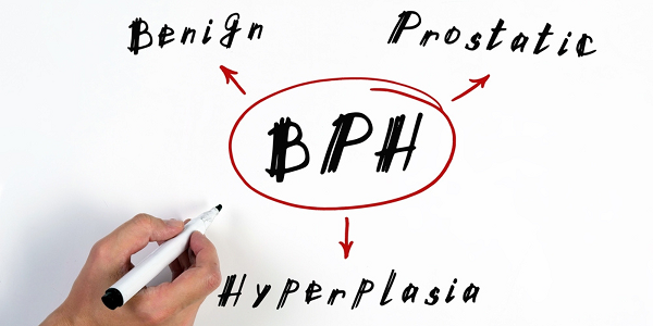 Role of Tamsulosin in treating BPH